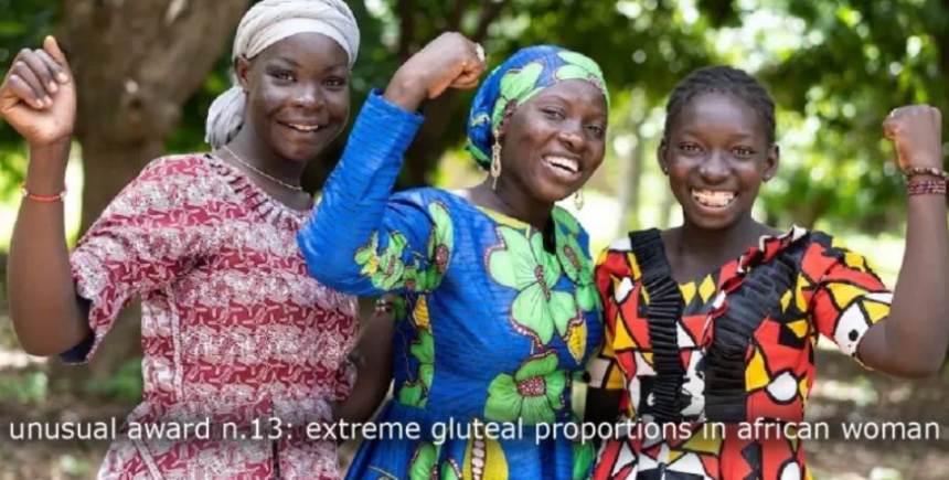 Unusual Award N.13: Extreme Gluteal Proportions in African Woman